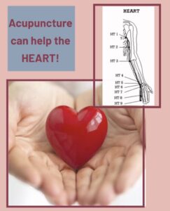 Acupuncture for heart health