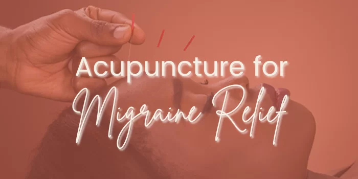 Acupuncture for migraine
