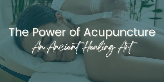 The Power of Acupuncture